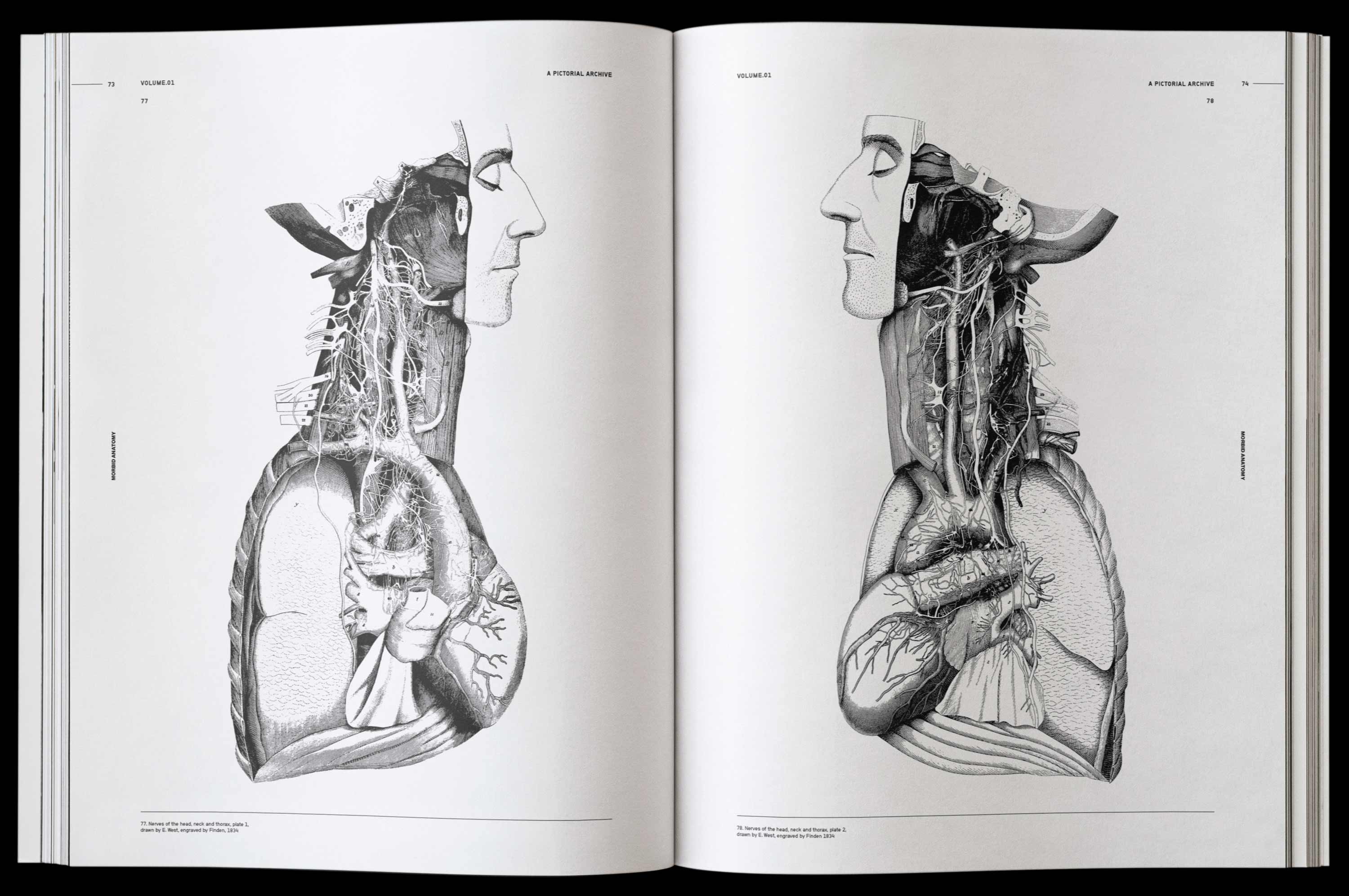 Vault Editions Morbid Anatomy Book by James Kale