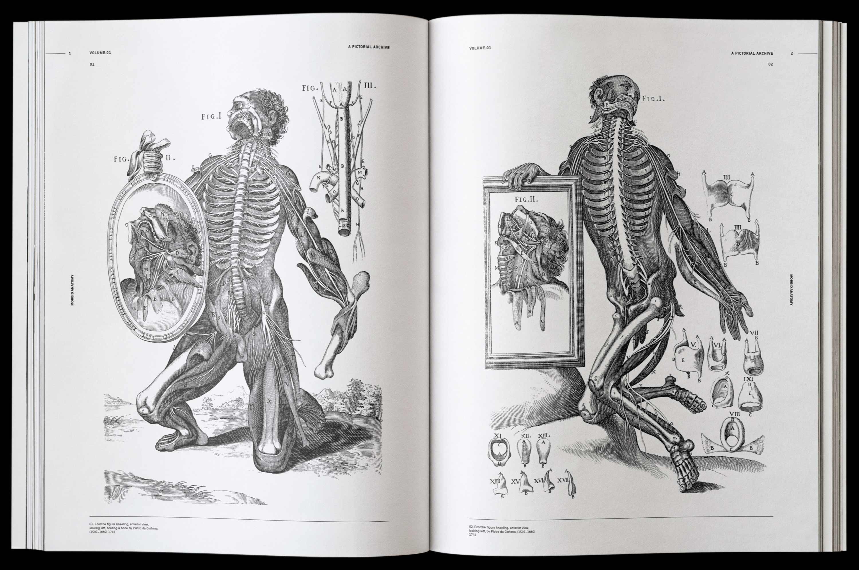 Vault Editions Morbid Anatomy Book by James Kale