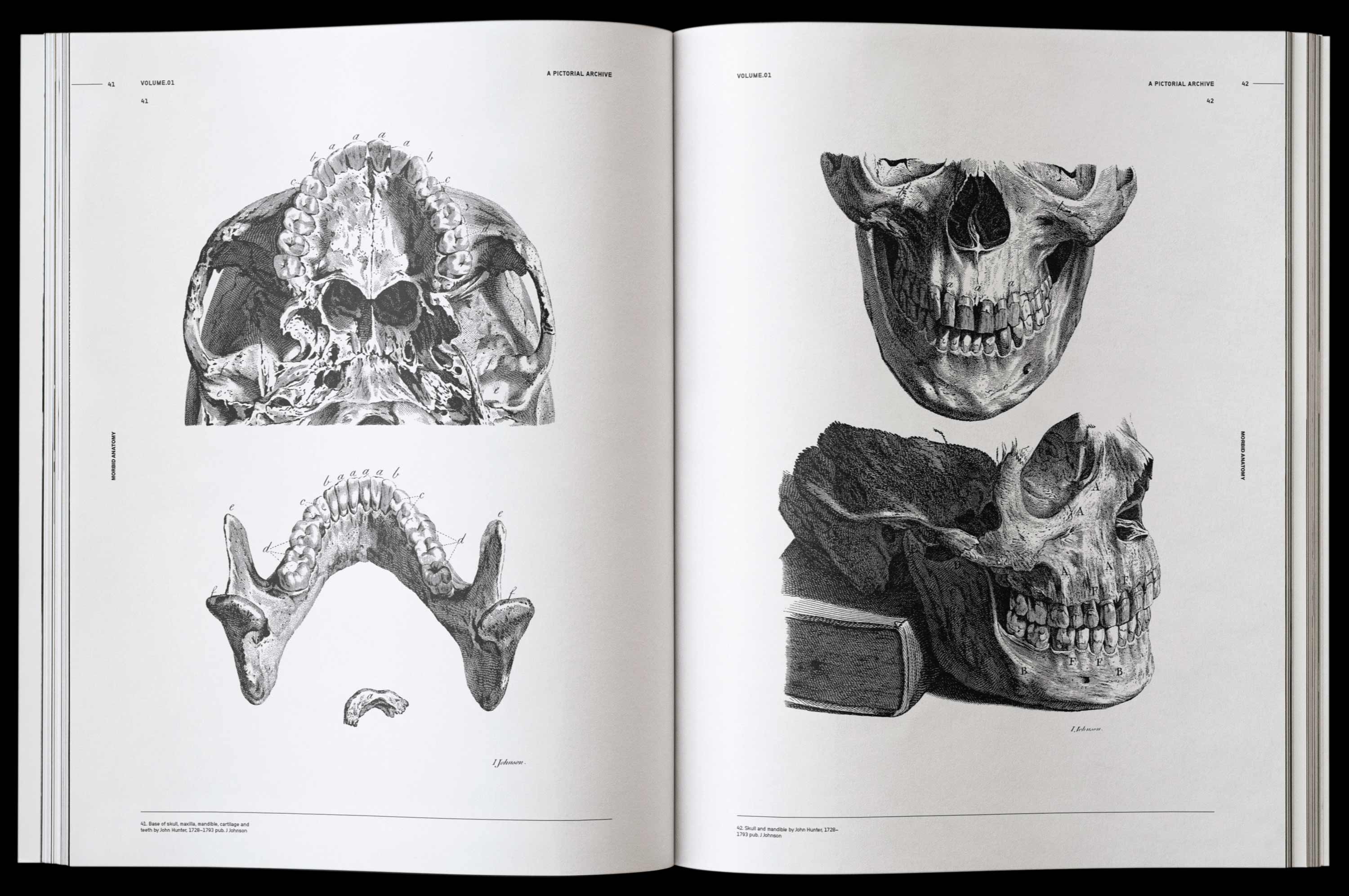 Vault Editions Morbid Anatomy Book by James Kale