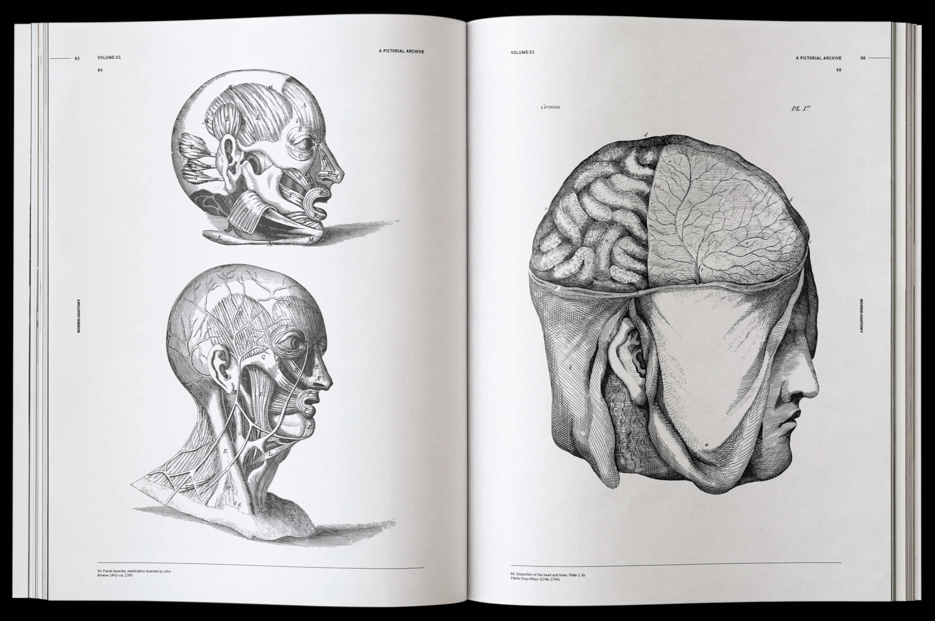 Vault Editions Morbid Anatomy Book by James Kale
