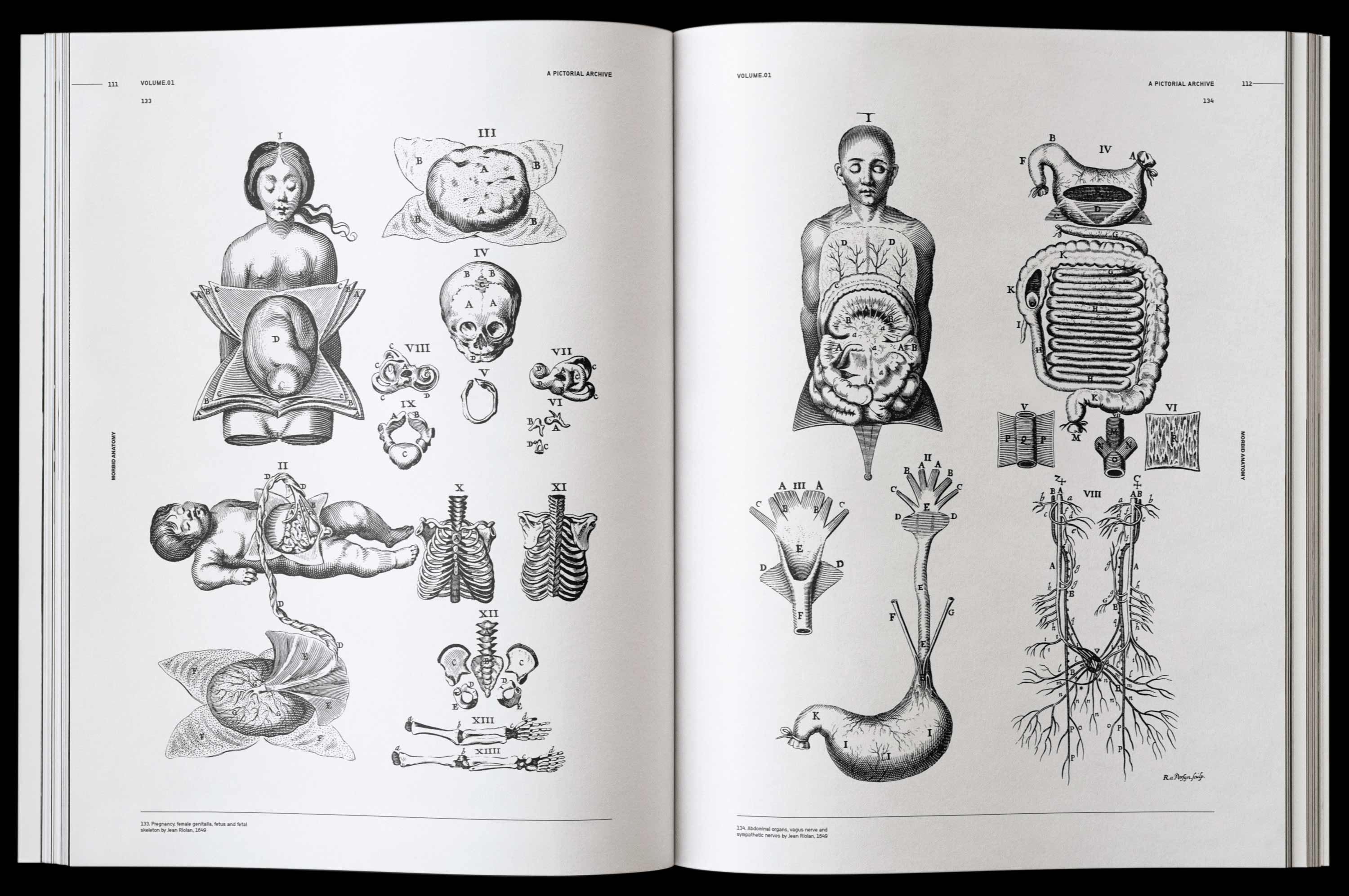 Vault Editions Morbid Anatomy Book by James Kale