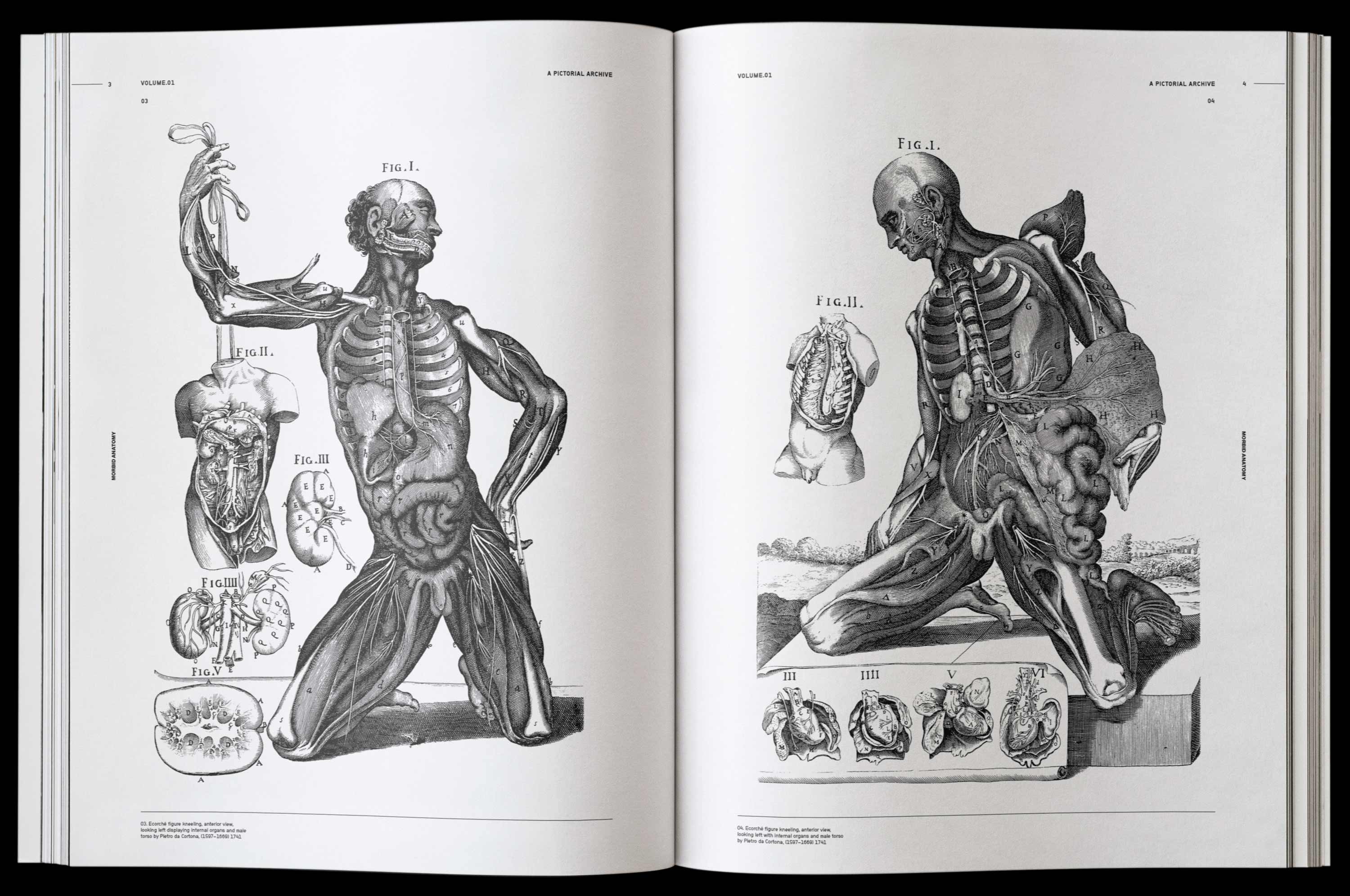 Vault Editions Morbid Anatomy Book by James Kale