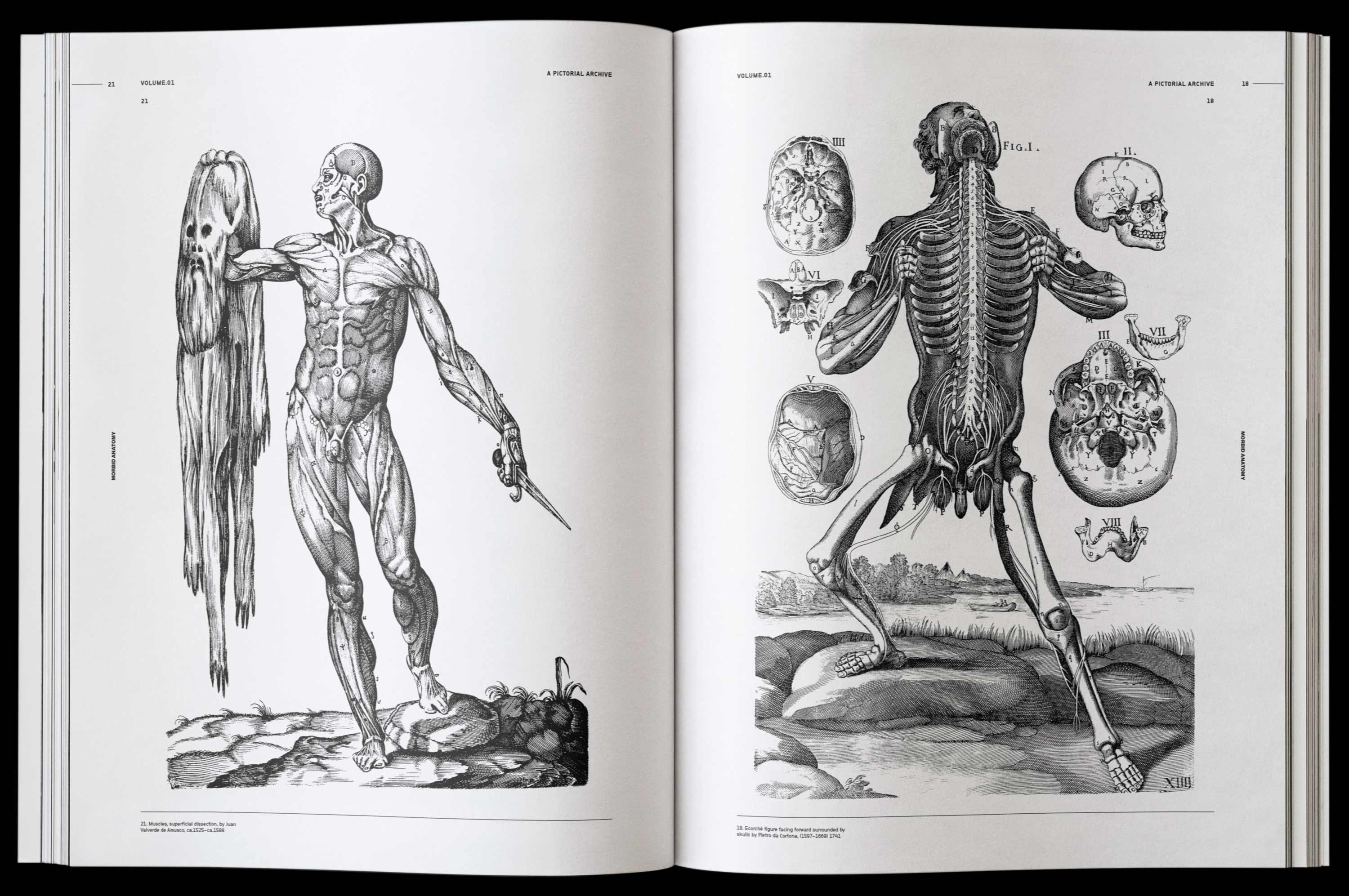 Vault Editions Morbid Anatomy Book by James Kale